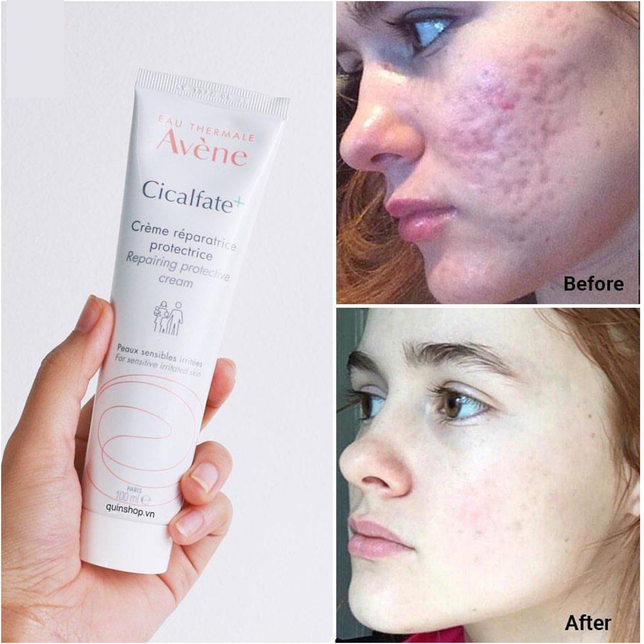 کرم ترمیم کننده پوست سیکالفیت پلاس اون Avene حجم 100 میل